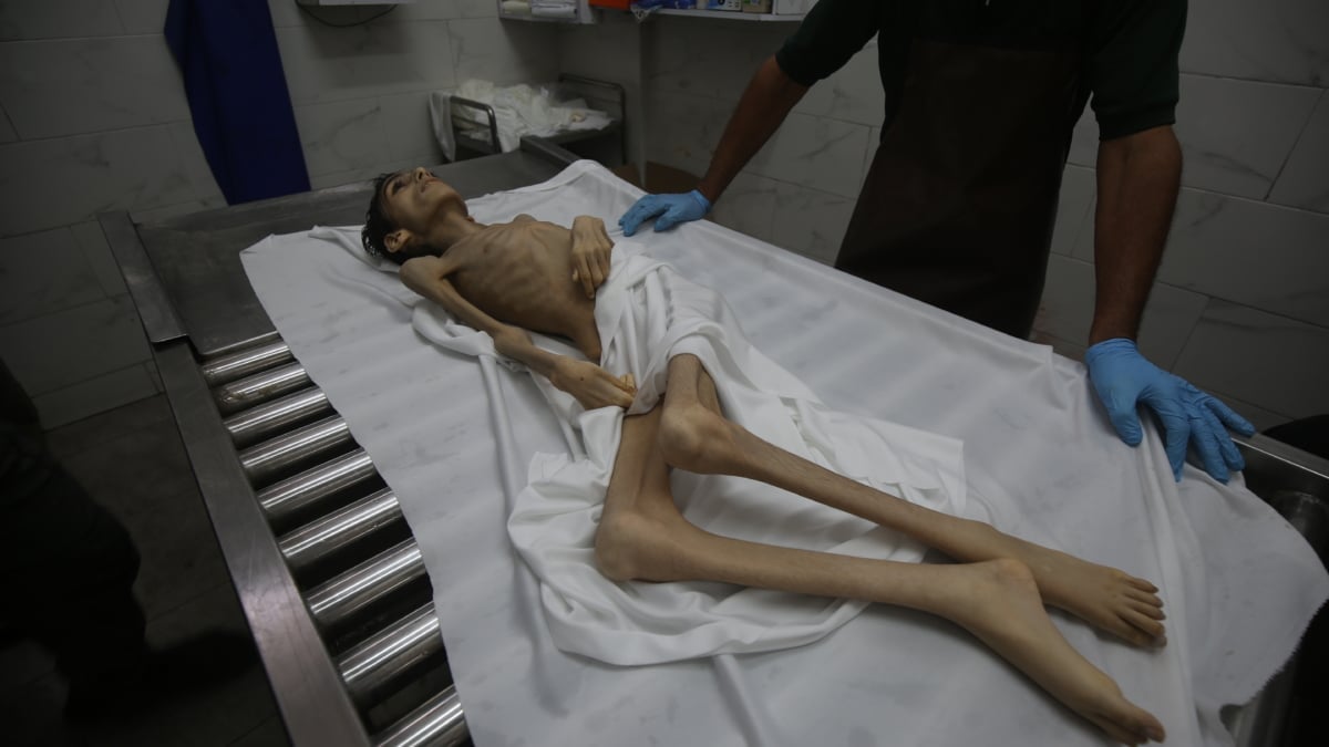 La famine dans le Gaza assiégée fait 300 morts, dont 117 enfants