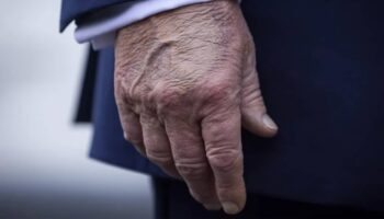 La mauvaise santé de Trump, un secret de polichinelle